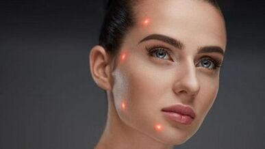 ما هو تجديد الجلد الجزئي